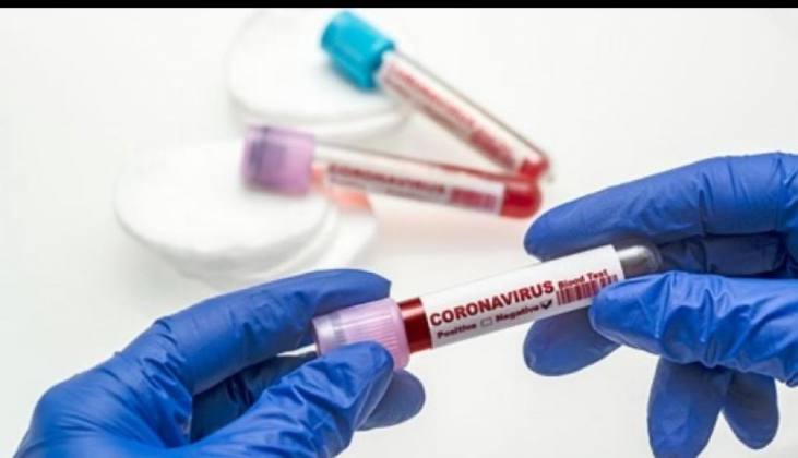 E337057E E057 4C53 9862 F8913857B860