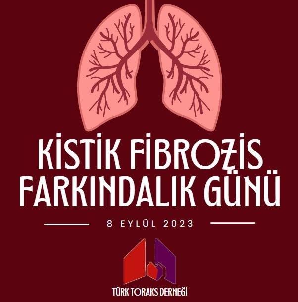 1694264686 577 Kistik Fibrozis Ilaclari Acilen Geri Odeme Kapsaminda Alinmali