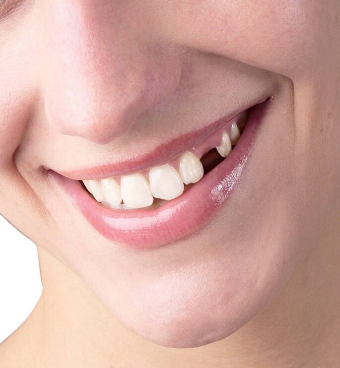 Urfa Haberleri Anestezi Altında Diş Tedavisi Sadece Ameliyathanede Yapılmalı