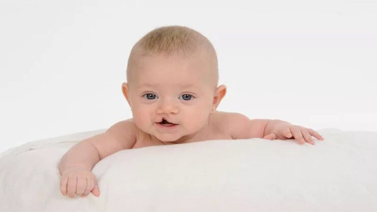 2024 01 dudak ve damak yariginda sanliurfa ve diyarbakir basi cekiyor scaled