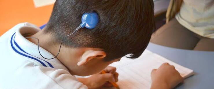 İkizler Koklear İmplantasyon (Biyonik Kulak) Ameliyatı ile Duyacak