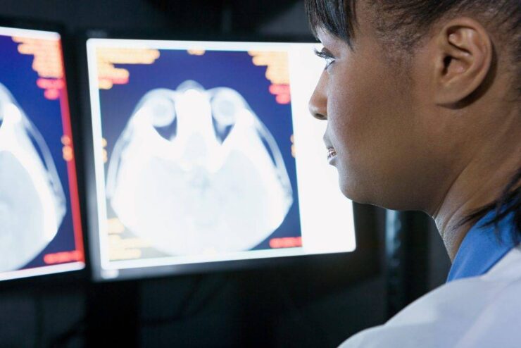 doctor looking at brain scans 2023 11 27 05 33 35 utc 1024x683 scaled