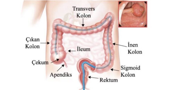 Goruntu 15.01.2025 22.50 scaled
